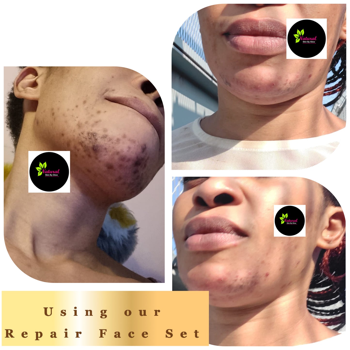 Pinky lip Set - NaturalSkinGlow