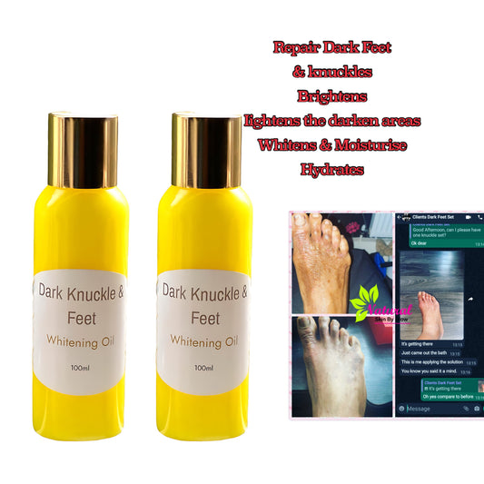 Dark Feet & Knuckle Milk - NaturalSkinGlow