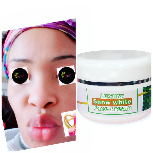 Snow White Face Cream - NaturalSkinGlow