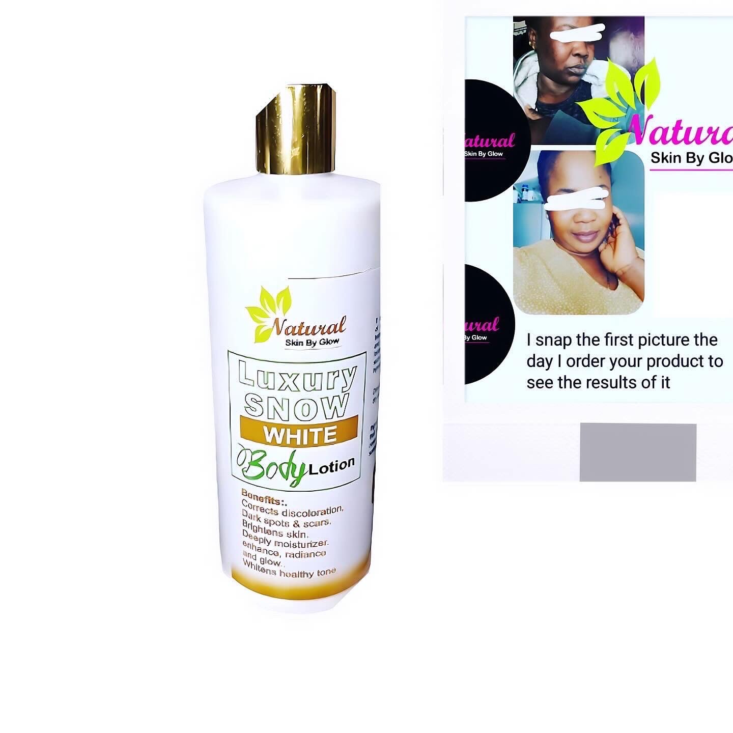 Snow White Lotion - NaturalSkinGlow
