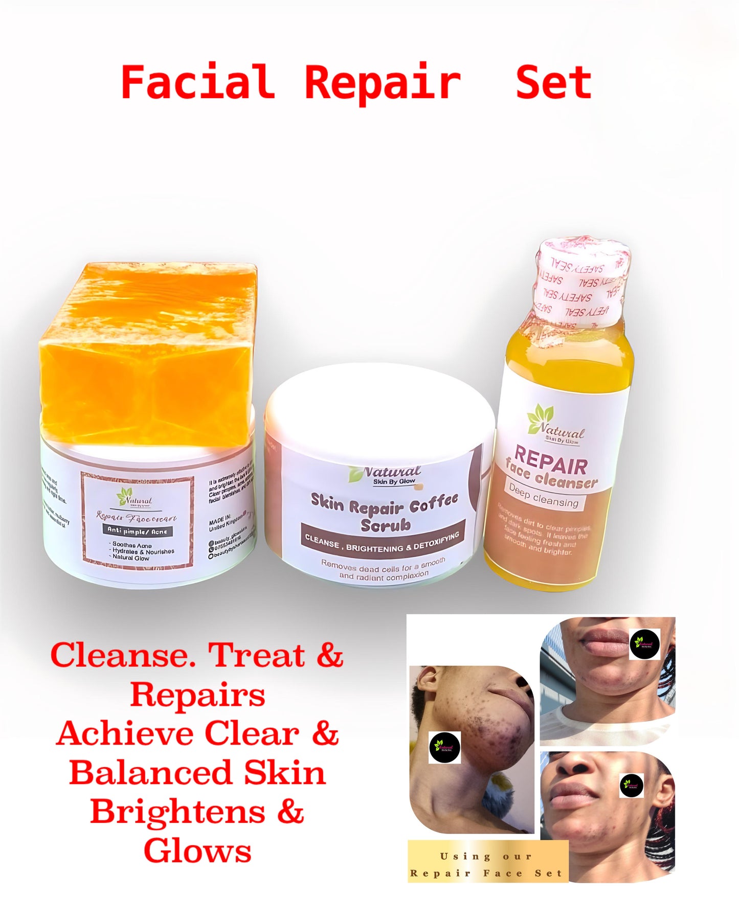 Repair Facial Set - NaturalSkinGlow
