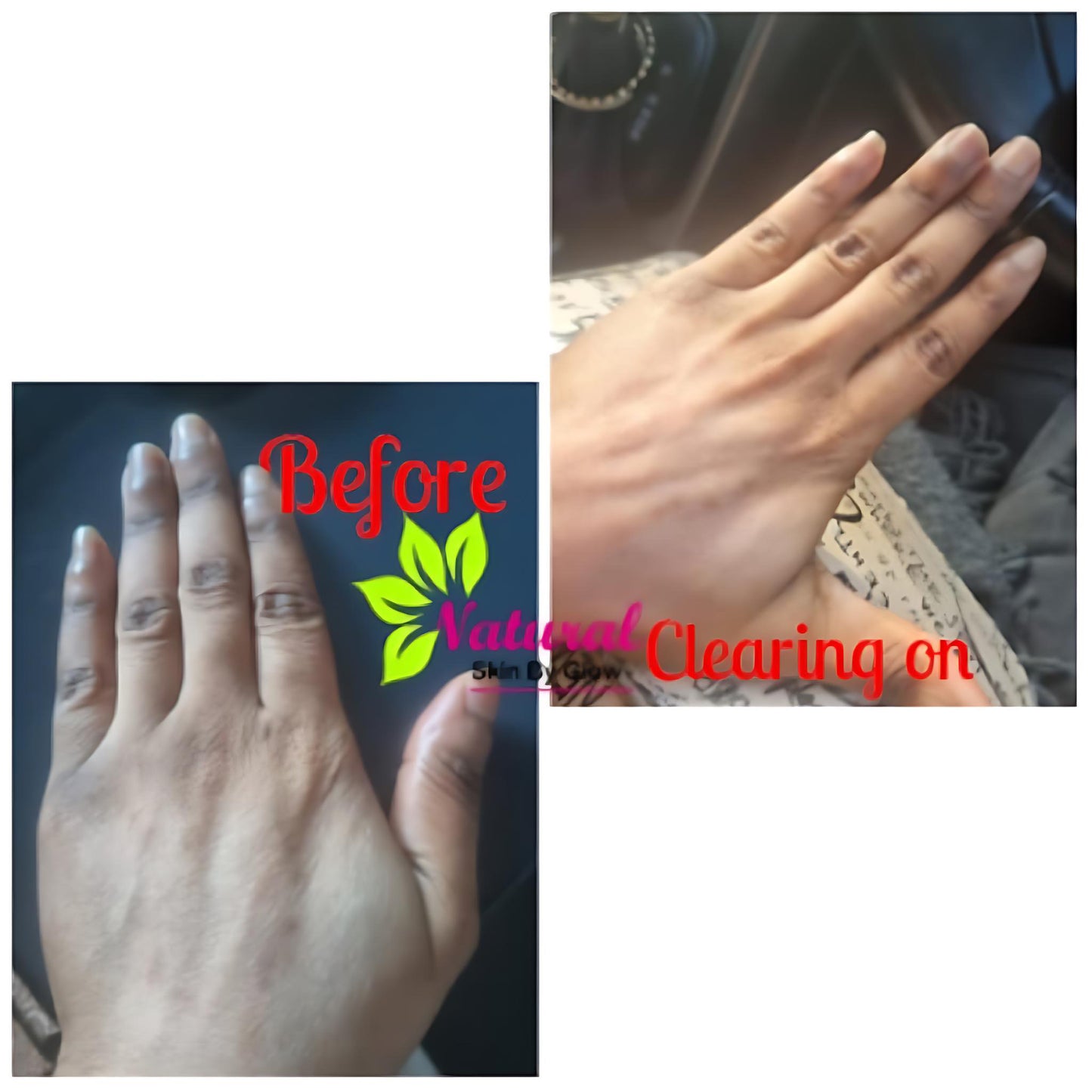 Dark Knuckle Eraser Cream - NaturalSkinGlow