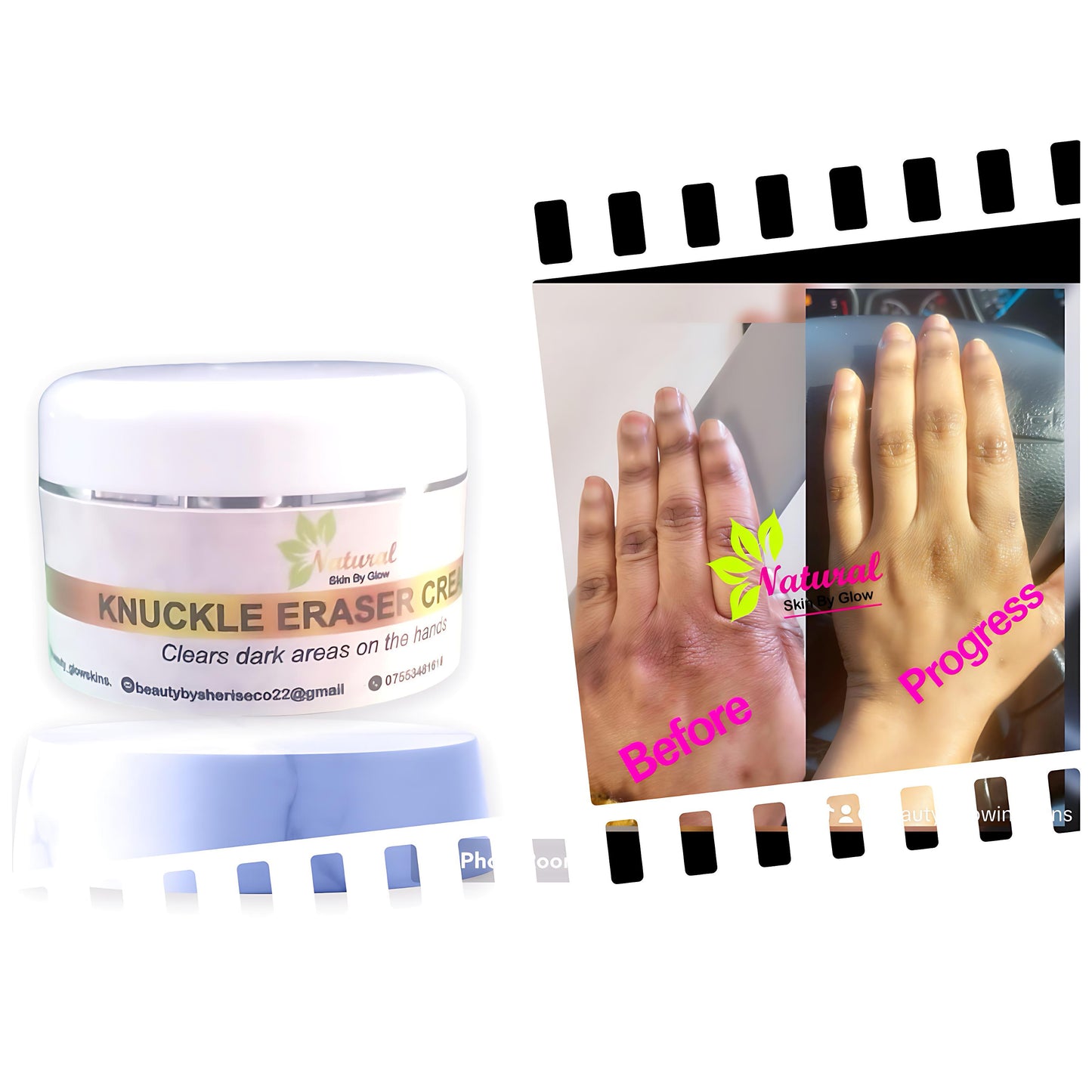 Dark Knuckle Eraser Cream - NaturalSkinGlow