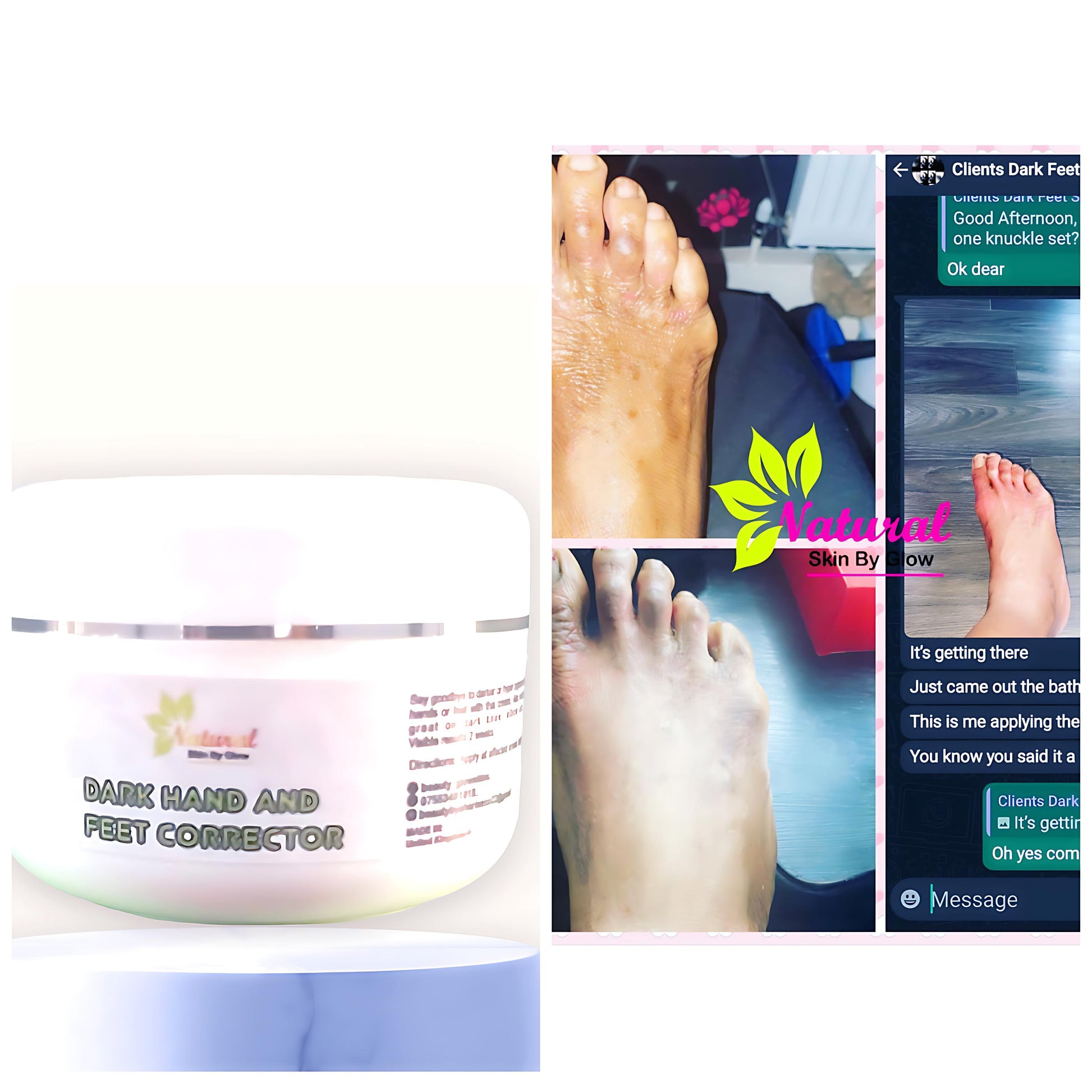 Dark feet corrector cream - NaturalSkinGlow