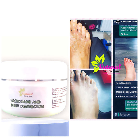 Dark feet corrector cream